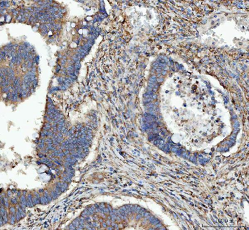 RPL18 Antibody