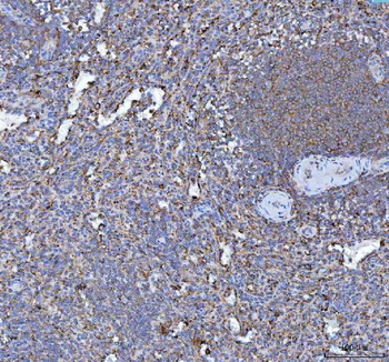 RPL18 Antibody