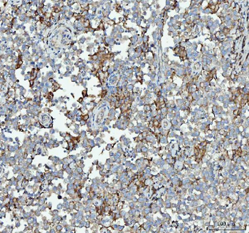 RPL18 Antibody