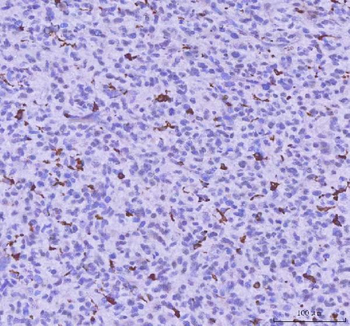 LPCAT2 Rabbit Polyclonal Antibody