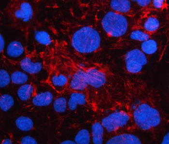 LAD1 Rabbit Polyclonal Antibody