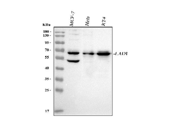 LAD1 Rabbit Polyclonal Antibody