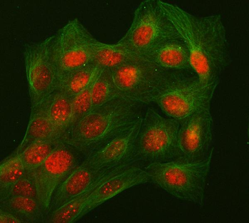 L3MBTL2 Rabbit Polyclonal Antibody