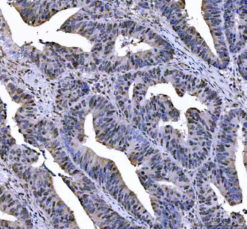 L3MBTL2 Rabbit Polyclonal Antibody