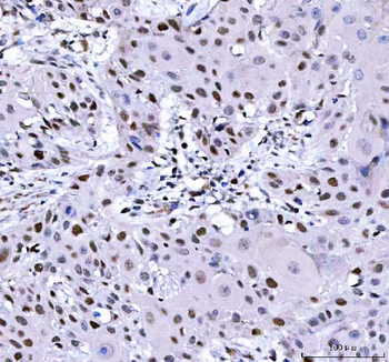 L3MBTL2 Rabbit Polyclonal Antibody