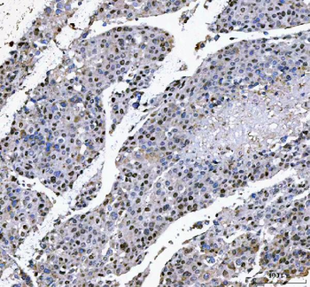 L3MBTL2 Rabbit Polyclonal Antibody