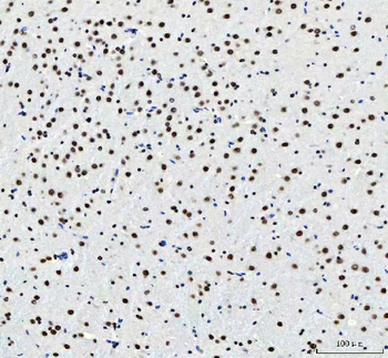 CROP/LUC7L3 Antibody