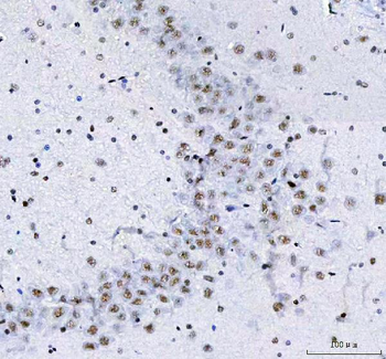 CROP/LUC7L3 Antibody