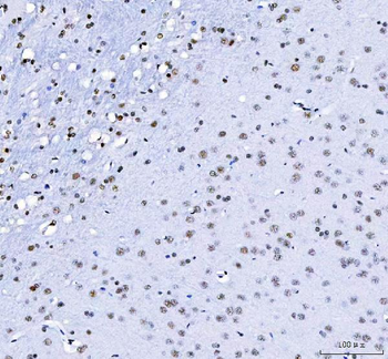CROP/LUC7L3 Antibody