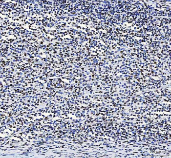 CROP/LUC7L3 Antibody