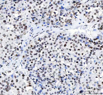 CROP/LUC7L3 Antibody