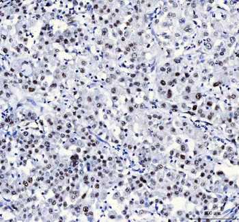 CROP/LUC7L3 Antibody
