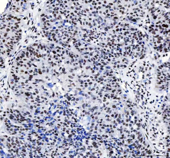 CROP/LUC7L3 Antibody