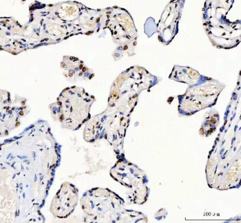 CROP/LUC7L3 Antibody