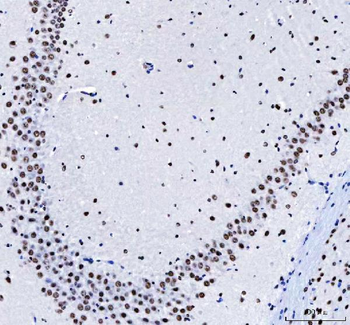 CROP/LUC7L3 Antibody