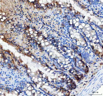 LRRC59 Rabbit Polyclonal Antibody