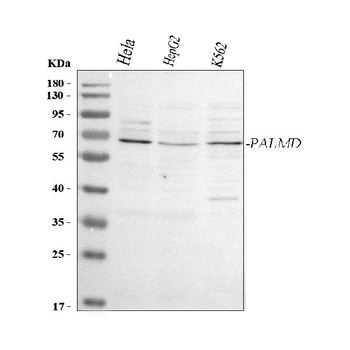 PALMD Rabbit Polyclonal Antibody