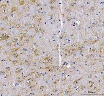LRRN1 Rabbit Polyclonal Antibody