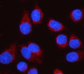 LGI4 Antibody