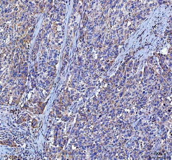 LGI4 Antibody