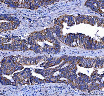 LGI4 Antibody