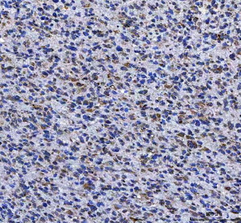 LGI4 Antibody