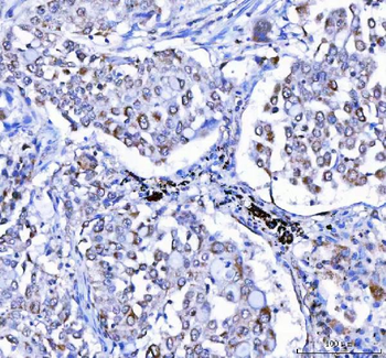 LGI4 Antibody