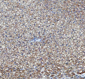 LDAH Rabbit Polyclonal Antibody