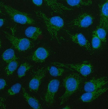 LCMT2 Rabbit Polyclonal Antibody