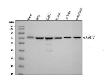 LCMT2 Rabbit Polyclonal Antibody