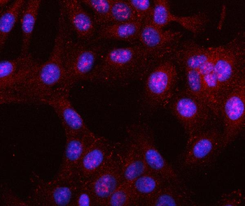 LRRN4 Rabbit Polyclonal Antibody