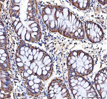 LRRN4 Rabbit Polyclonal Antibody