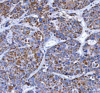 LRRN4 Rabbit Polyclonal Antibody