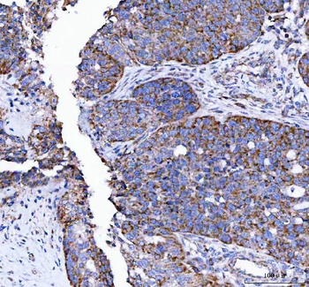 LRRN4 Rabbit Polyclonal Antibody