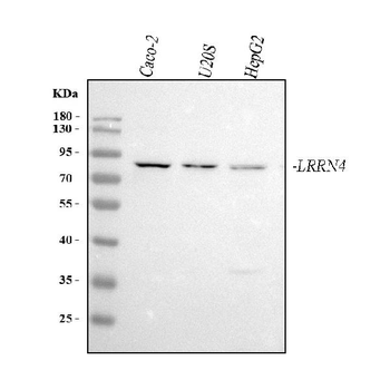LRRN4 Rabbit Polyclonal Antibody