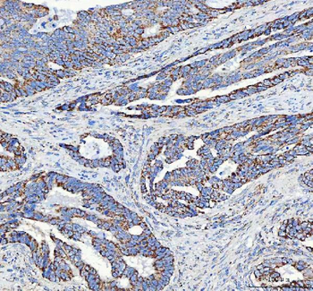 ATP5F1D Antibody
