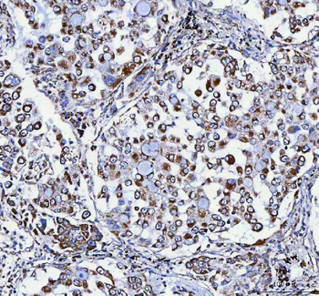 ATP5F1D Antibody