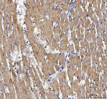 ATP5F1D Antibody