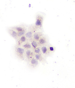 GAD67/GAD1 Rabbit Polyclonal Antibody