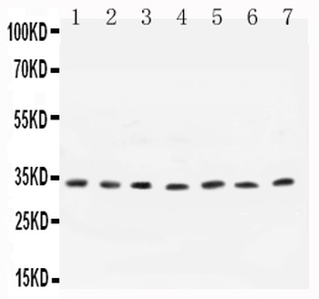 Cyclin D1/CCND1 Rabbit Polyclonal Antibody
