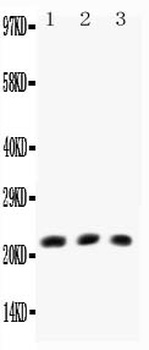 TNF beta/LTA Rabbit Polyclonal Antibody