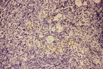 GM-CSF/CSF2 Antibody