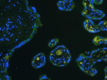 Integrin beta 4/ITGB4 Rabbit Polyclonal Antibody