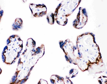 Integrin beta 4/ITGB4 Rabbit Polyclonal Antibody