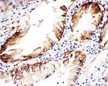 Integrin beta 4/ITGB4 Rabbit Polyclonal Antibody