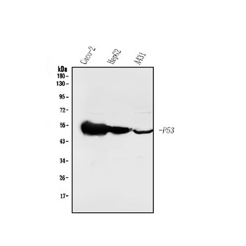 P53/TP53 Rabbit Polyclonal Antibody