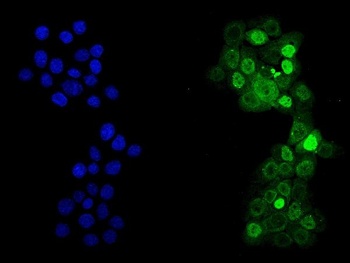P53/TP53 Rabbit Polyclonal Antibody