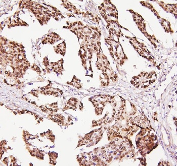 P53/TP53 Rabbit Polyclonal Antibody