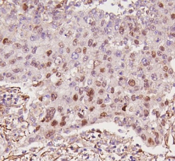 P53/TP53 Rabbit Polyclonal Antibody