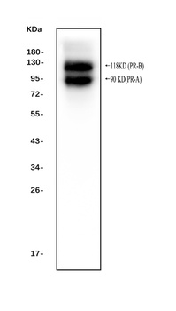Progesterone Receptor/PGR Rabbit Polyclonal Antibody